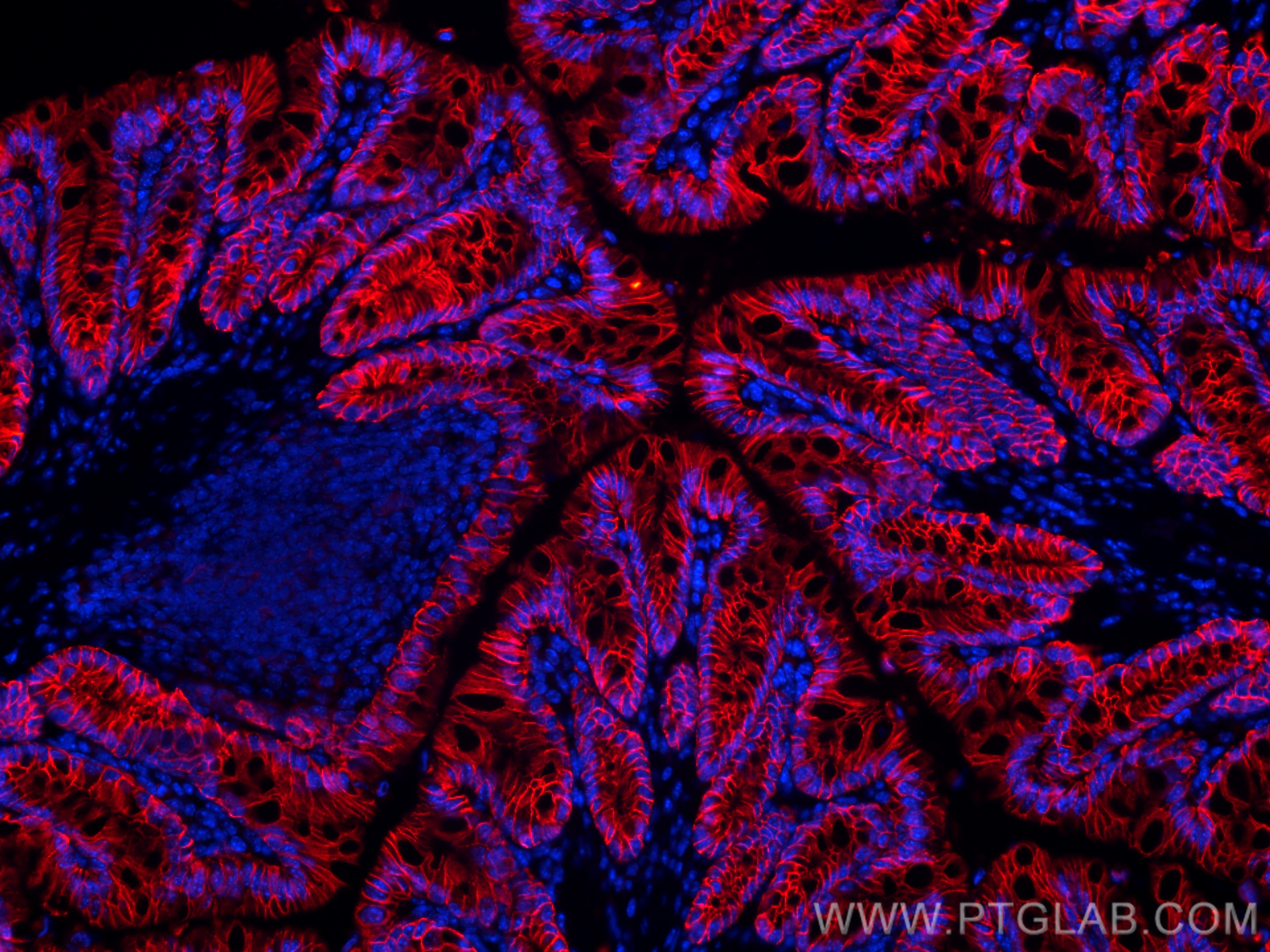 Immunofluorescence (IF) / fluorescent staining of mouse colon tissue using EPCAM/CD326 Polyclonal antibody (32189-1-AP)