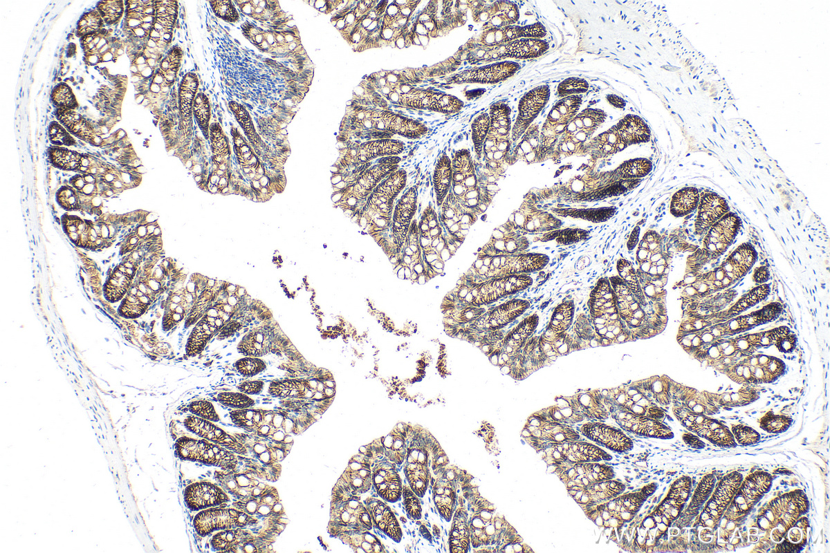 Immunohistochemistry (IHC) staining of mouse colon tissue using EPCAM/CD326 Polyclonal antibody (32189-1-AP)