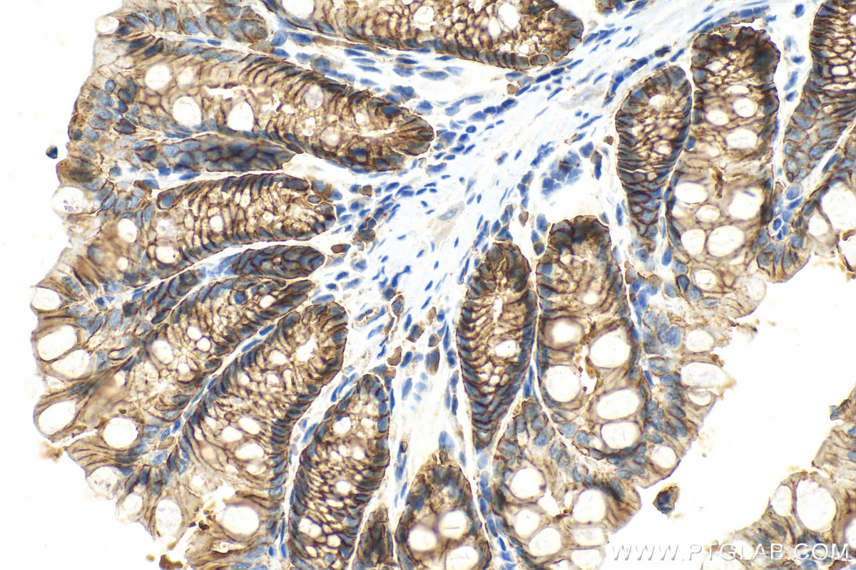 Immunohistochemistry (IHC) staining of mouse colon tissue using EPCAM/CD326 Polyclonal antibody (32189-1-AP)