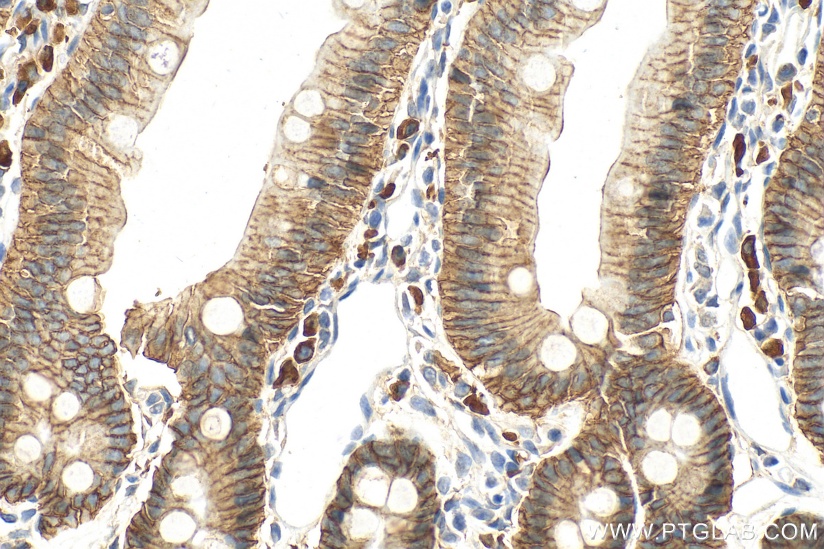 Immunohistochemistry (IHC) staining of rat small intestine tissue using EPCAM/CD326 Polyclonal antibody (32189-1-AP)