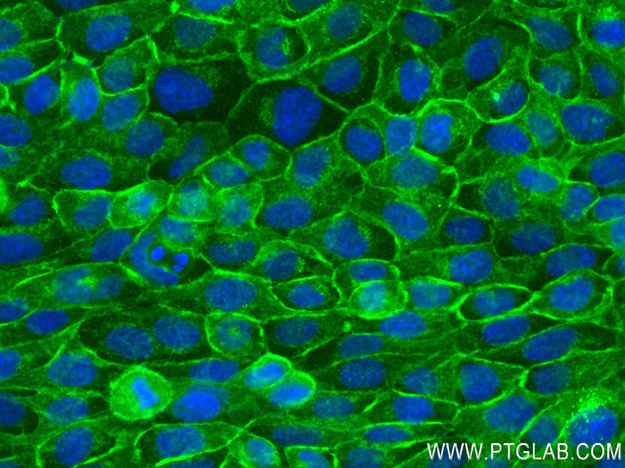 Immunofluorescence (IF) / fluorescent staining of A431 cells using EPCAM/CD326 Recombinant antibody (84073-6-RR)