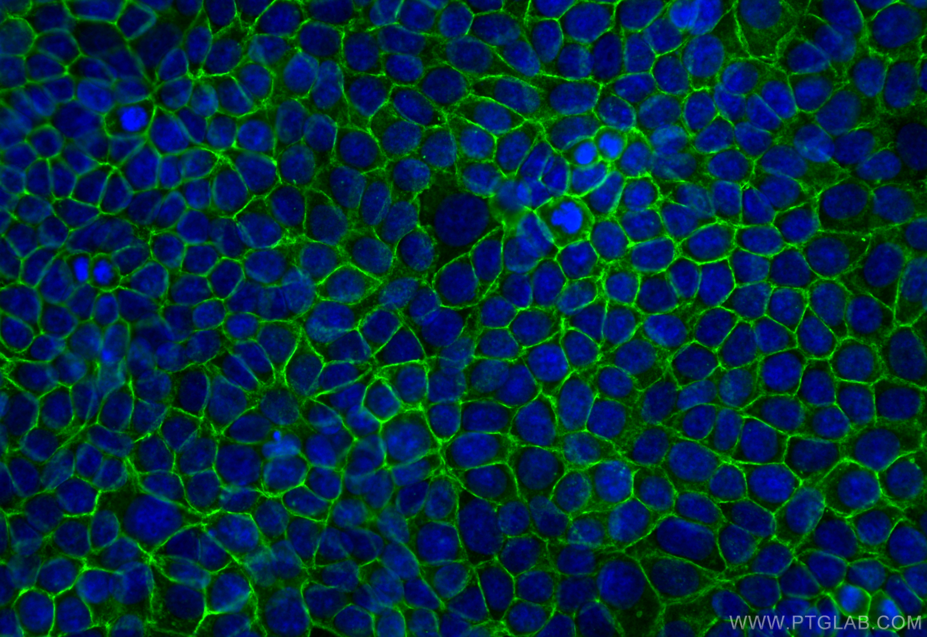 Immunofluorescence (IF) / fluorescent staining of MCF-7 cells using EPCAM/CD326 Recombinant antibody (84073-6-RR)