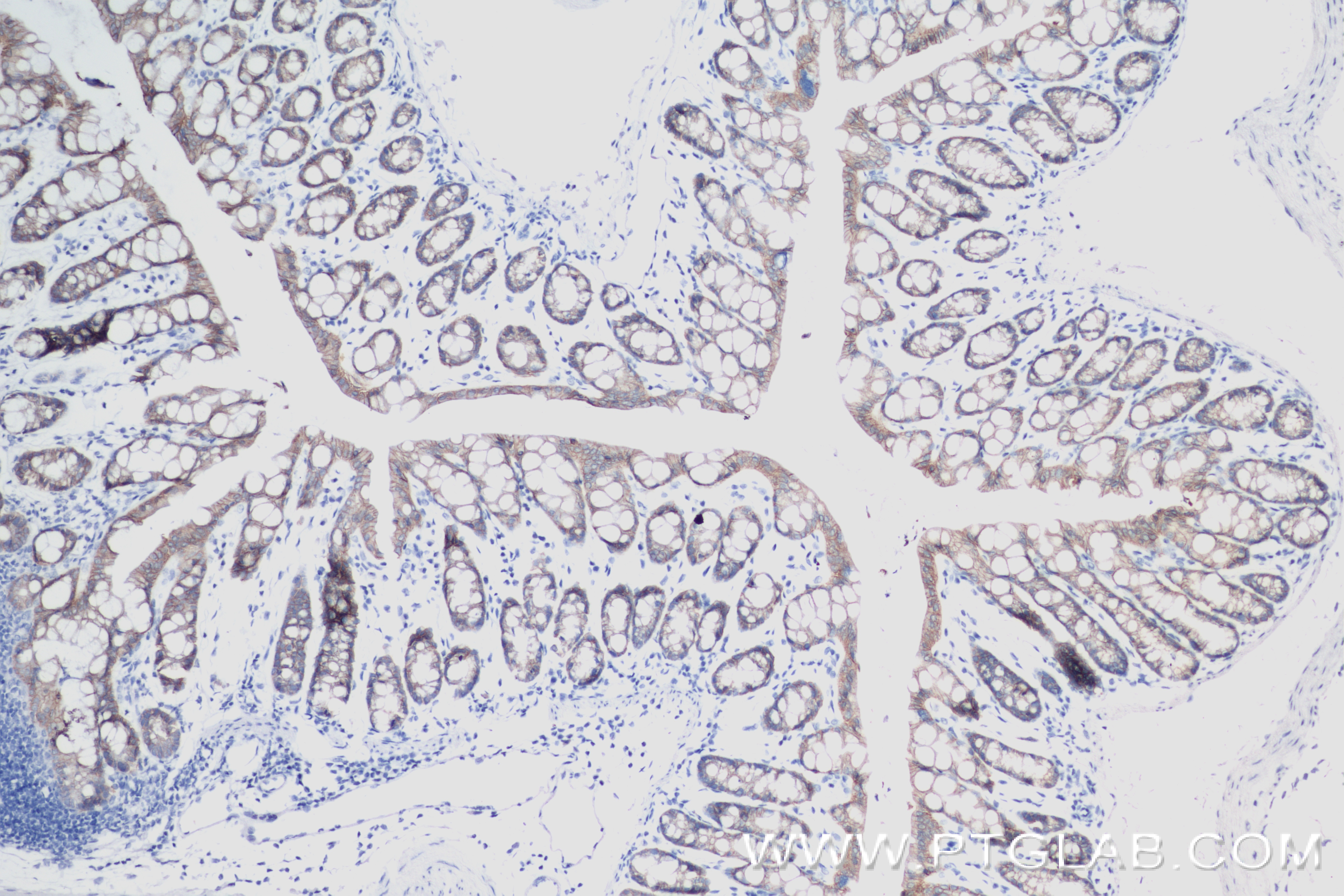 Immunohistochemistry (IHC) staining of mouse colon tissue using EPCAM/CD326 Recombinant antibody (84490-2-RR)