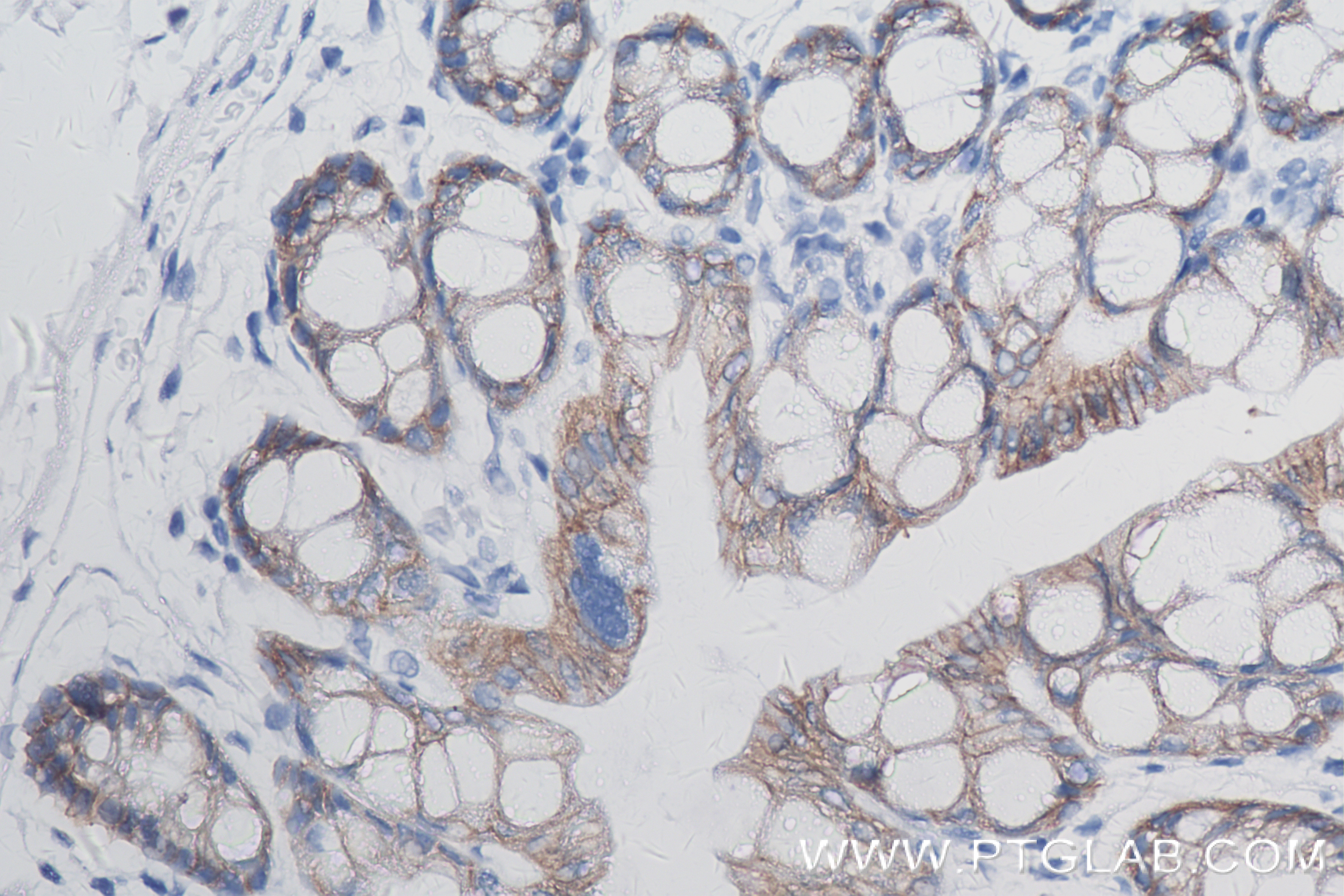 Immunohistochemistry (IHC) staining of mouse colon tissue using EPCAM/CD326 Recombinant antibody (84490-2-RR)