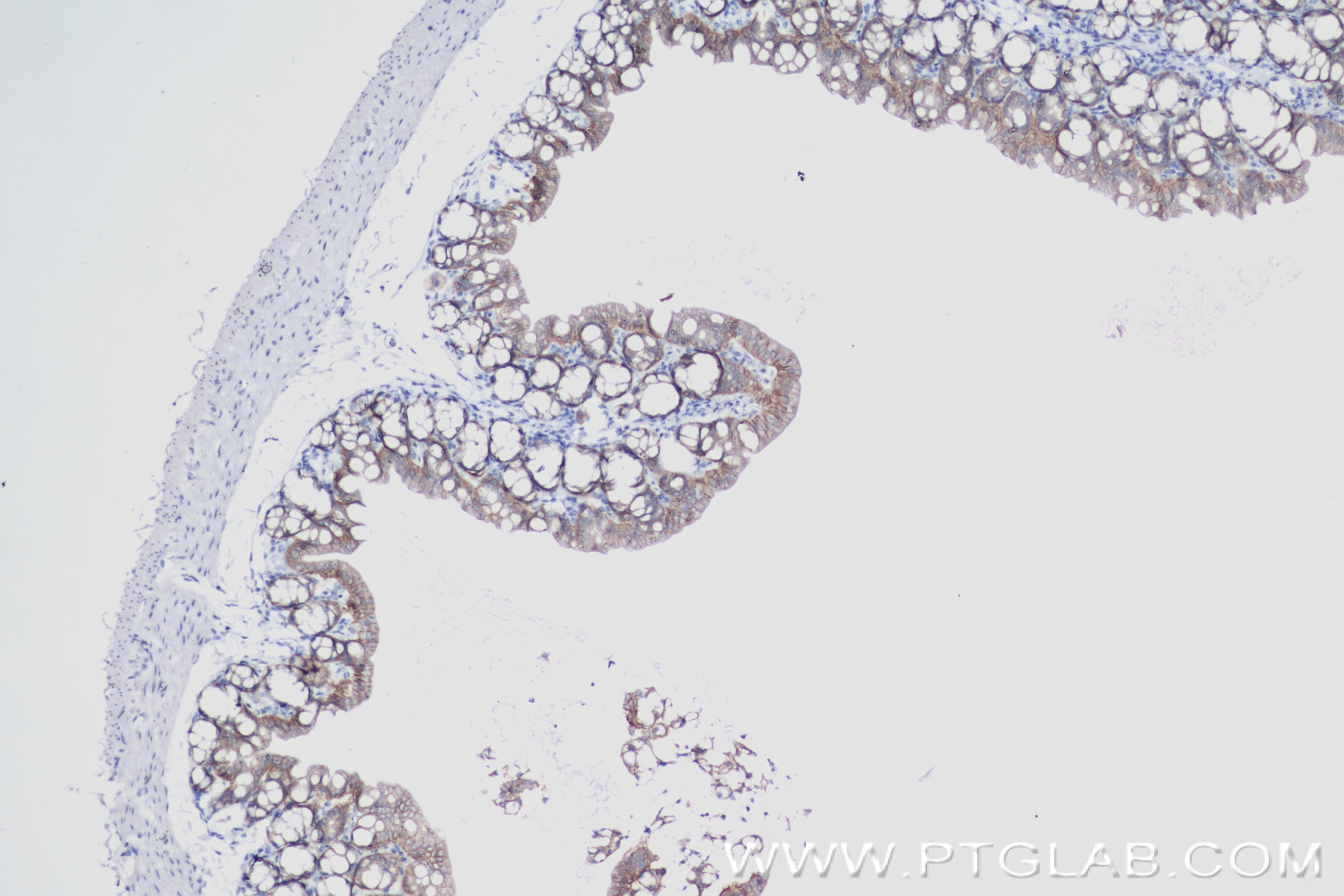 Immunohistochemistry (IHC) staining of mouse small intestine tissue using EPCAM/CD326 Recombinant antibody (84490-2-RR)