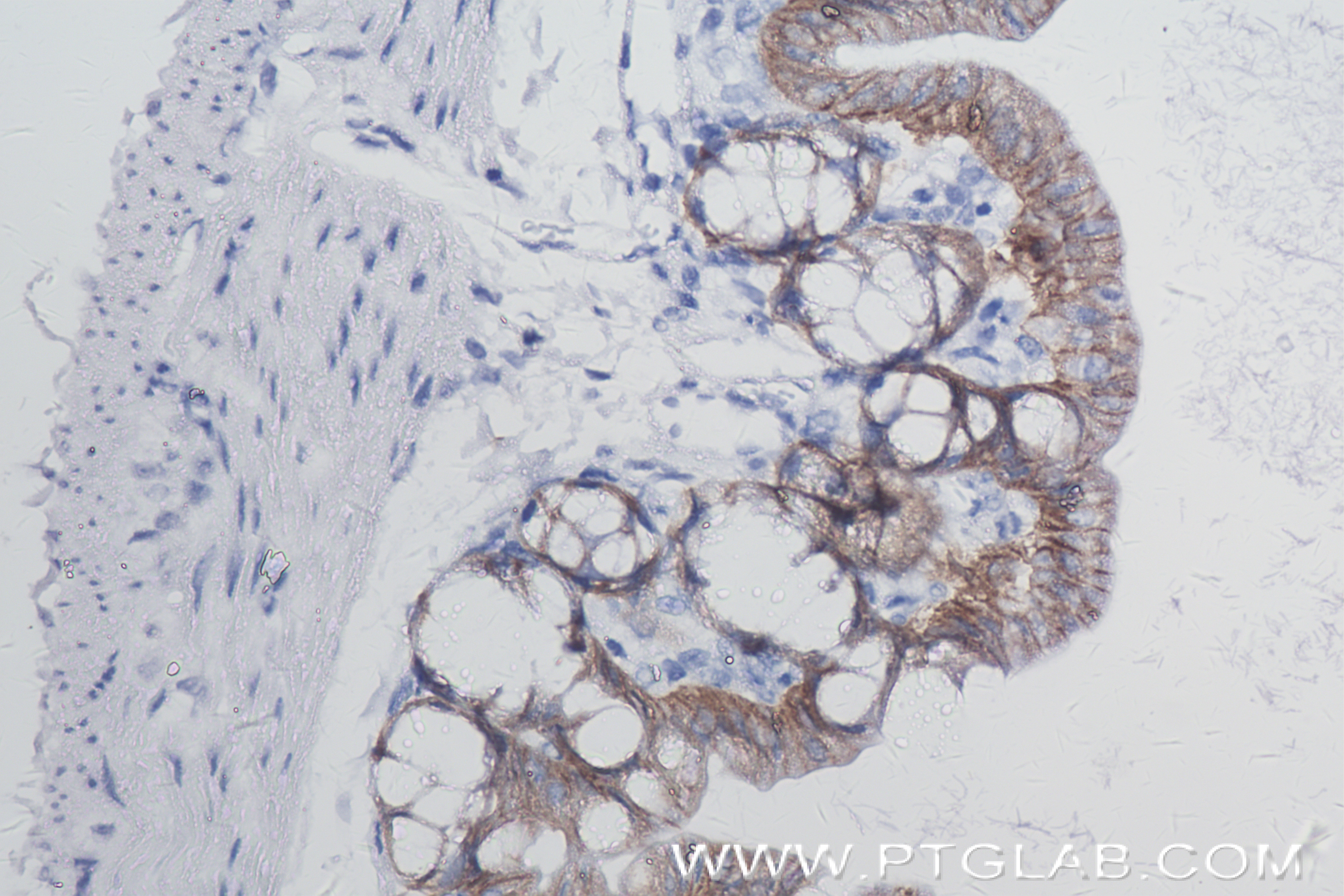 Immunohistochemistry (IHC) staining of mouse small intestine tissue using EPCAM/CD326 Recombinant antibody (84490-2-RR)