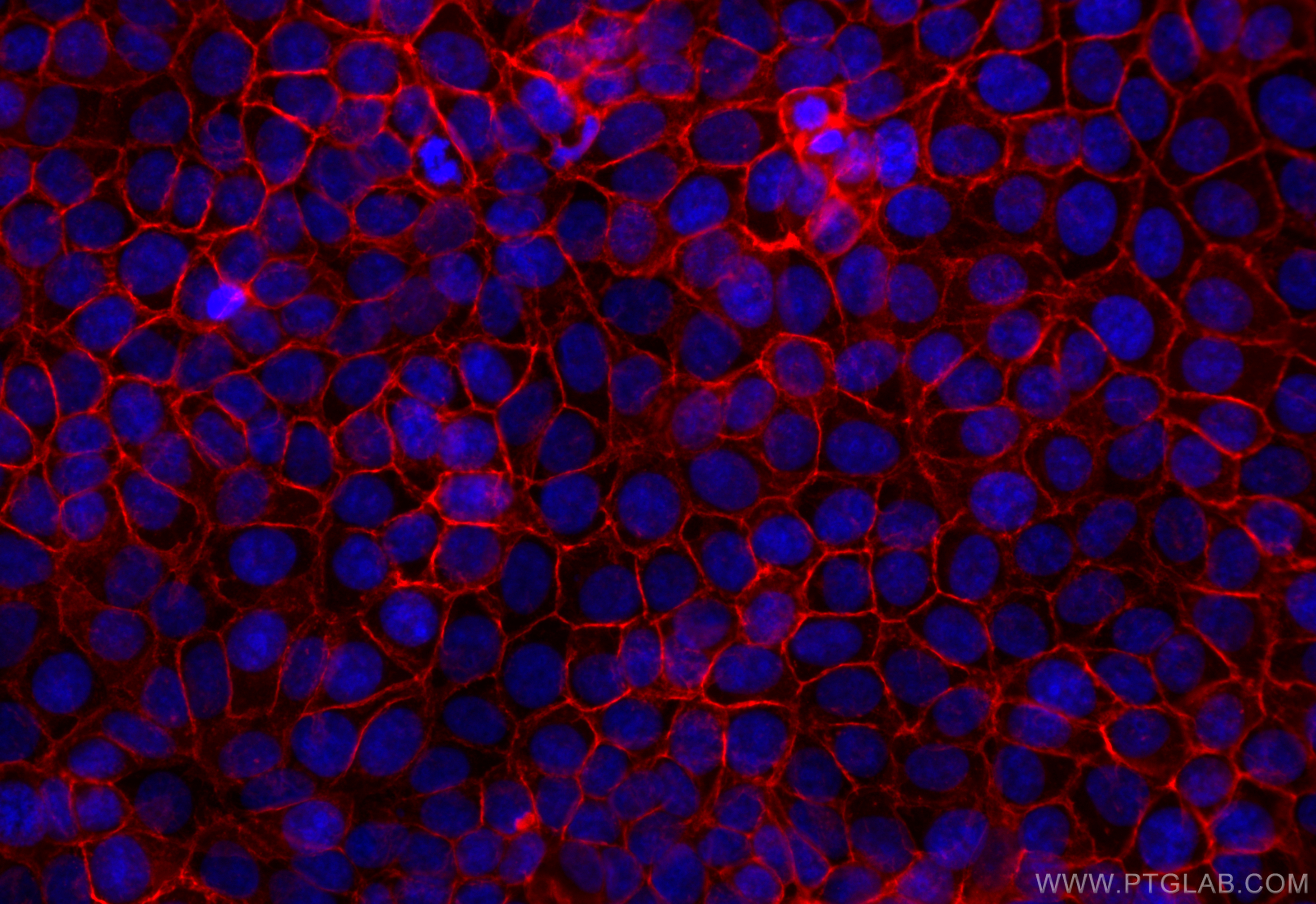 Immunofluorescence (IF) / fluorescent staining of MCF-7 cells using CoraLite®594-conjugated EPCAM/CD326 Recombinant an (CL594-84073-6)