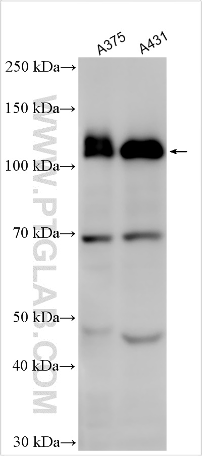 Western Blot (WB) analysis of various lysates using EPHA2 Polyclonal antibody (25749-1-AP)