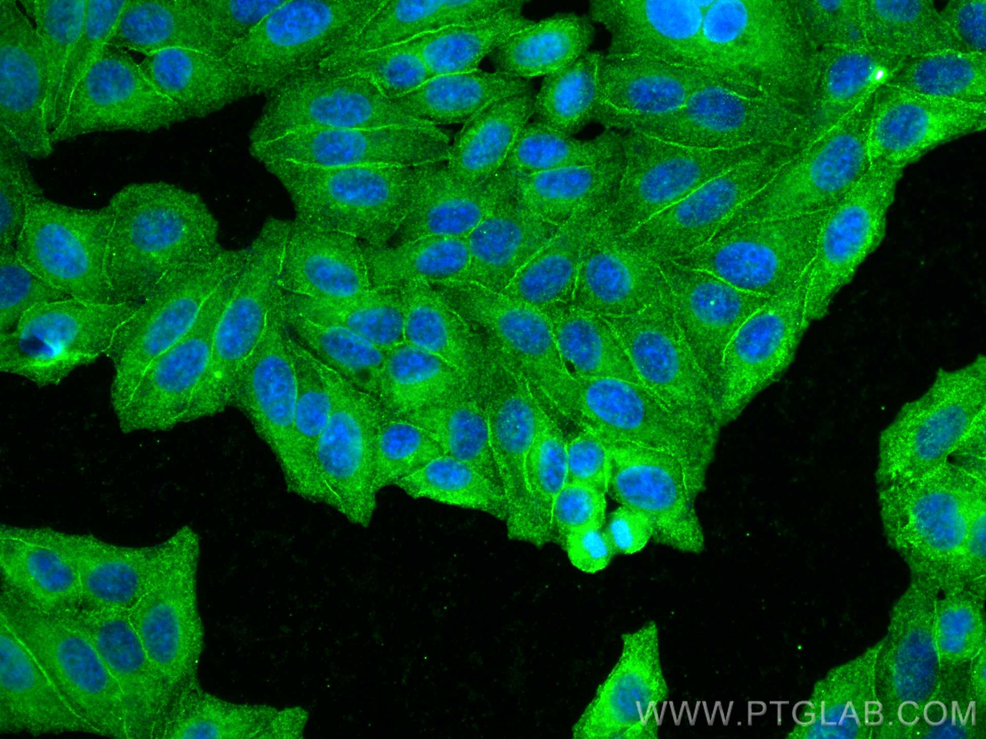 Immunofluorescence (IF) / fluorescent staining of HepG2 cells using EPHA2 Monoclonal antibody (66736-1-Ig)