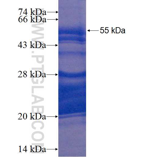 EPHA2 fusion protein Ag22661 SDS-PAGE