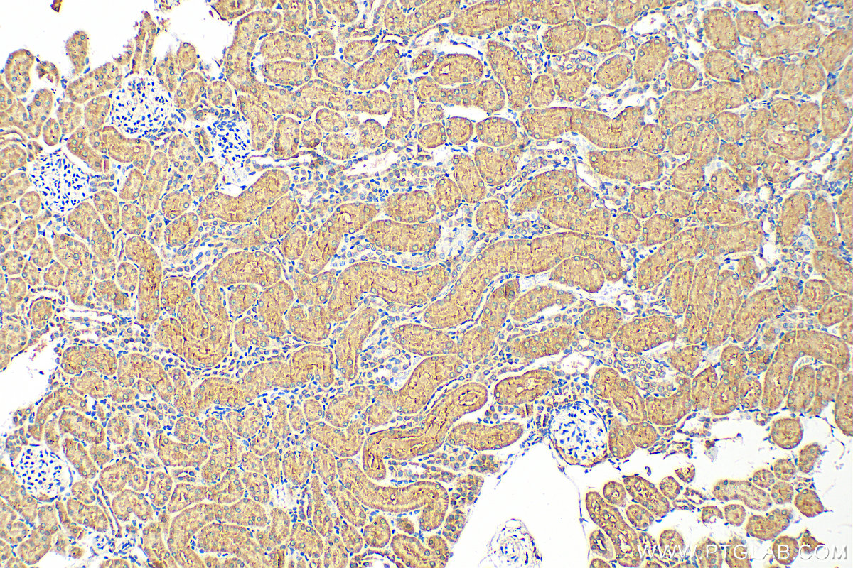 Immunohistochemistry (IHC) staining of rat kidney tissue using EPHX2 Polyclonal antibody (10833-1-AP)