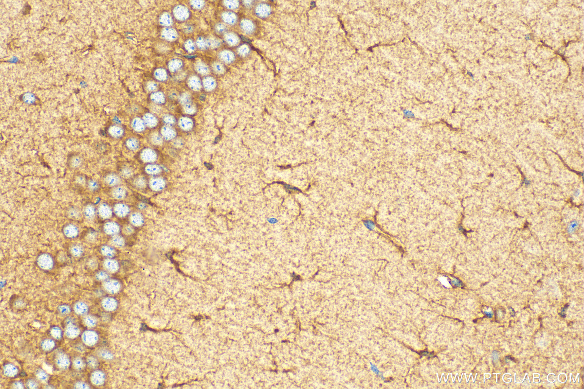 Immunohistochemistry (IHC) staining of mouse brain tissue using EPHX2 Polyclonal antibody (10833-1-AP)