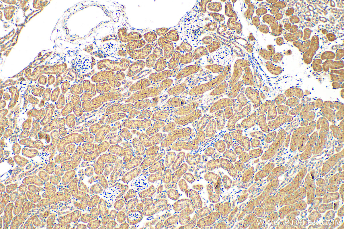 Immunohistochemistry (IHC) staining of mouse kidney tissue using EPHX2 Polyclonal antibody (10833-1-AP)