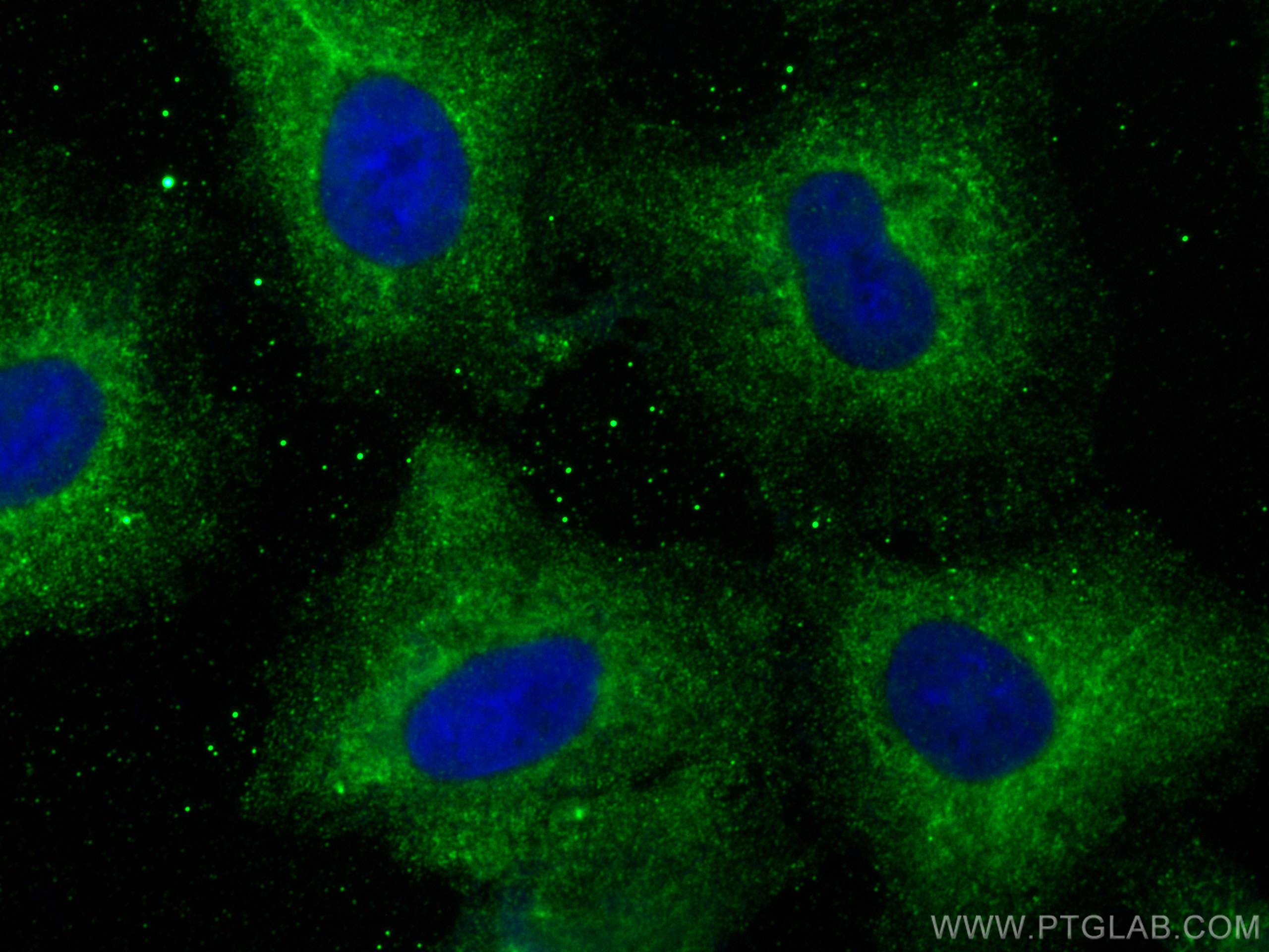 Immunofluorescence (IF) / fluorescent staining of A549 cells using EPHX3 Polyclonal antibody (25608-1-AP)