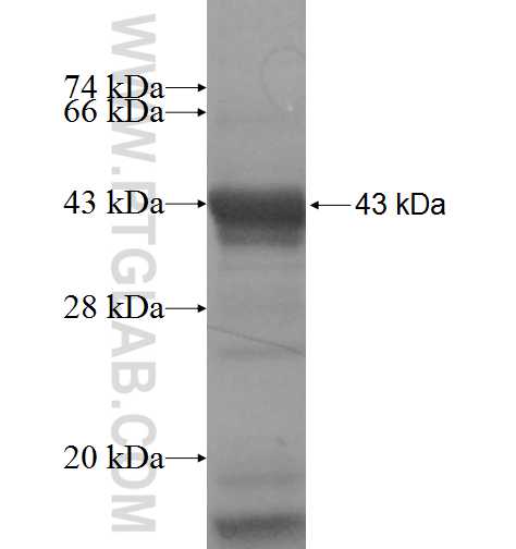 EPM2AIP1 fusion protein Ag5194 SDS-PAGE