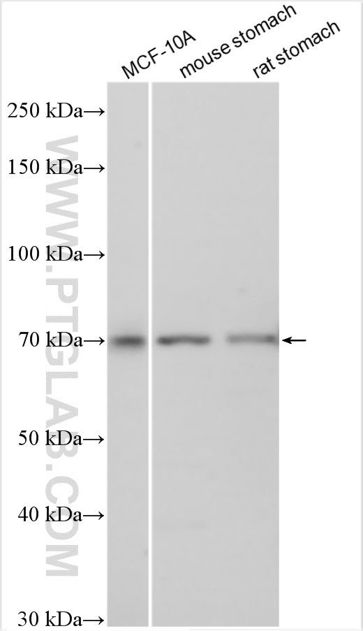 Western Blot (WB) analysis of various lysates using EPN3 Polyclonal antibody (20178-1-AP)