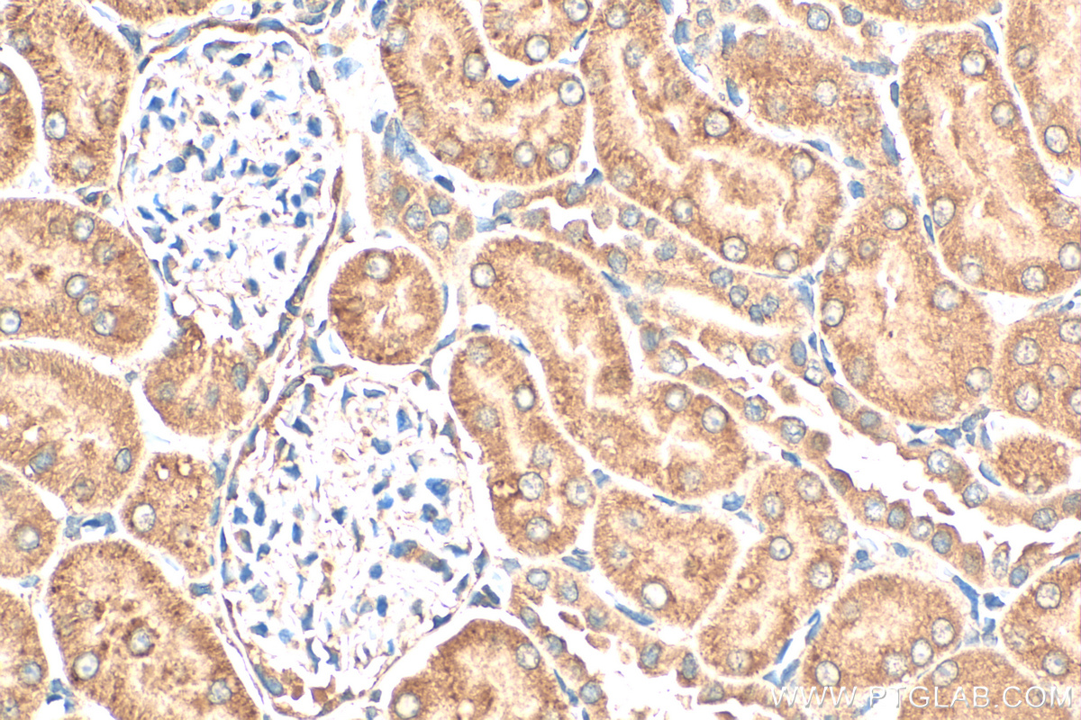 Immunohistochemistry (IHC) staining of rat kidney tissue using EPO/Erythropoietin Polyclonal antibody (17908-1-AP)