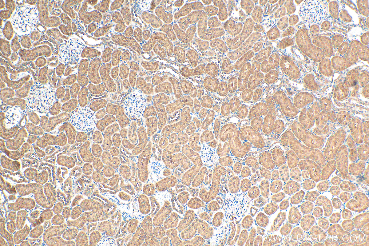 Immunohistochemistry (IHC) staining of rat kidney tissue using EPO/Erythropoietin Polyclonal antibody (17908-1-AP)