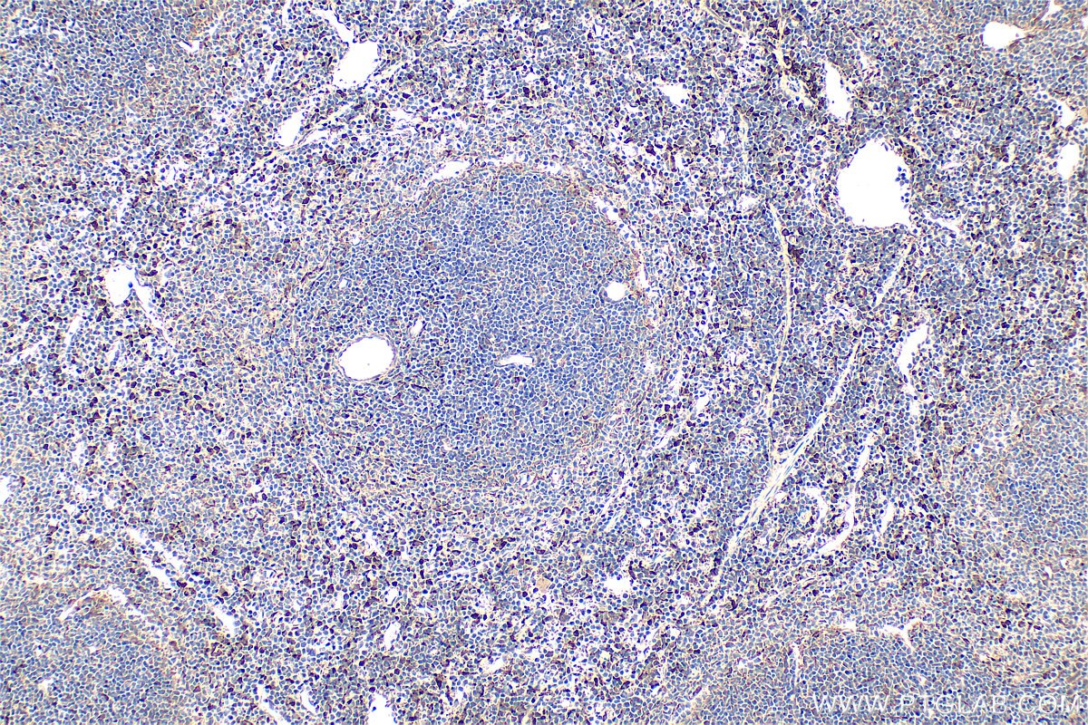Immunohistochemistry (IHC) staining of mouse spleen tissue using EPO/Erythropoietin Polyclonal antibody (17908-1-AP)