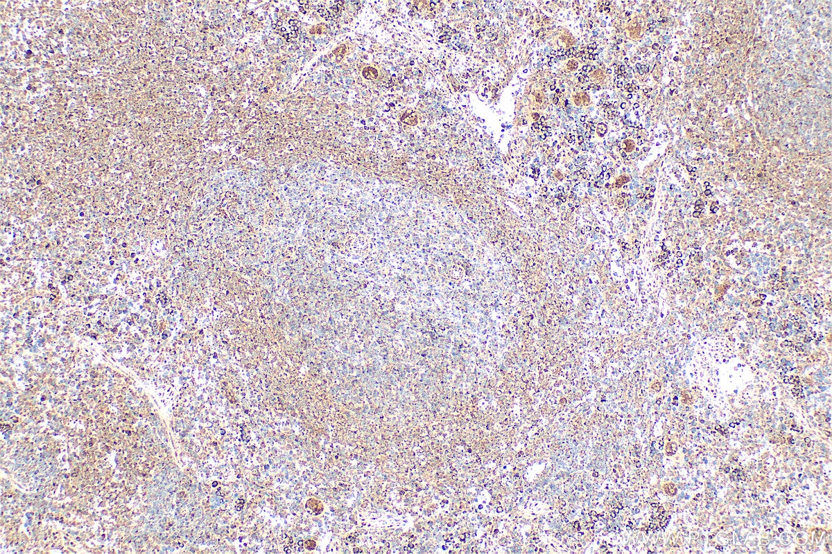 Immunohistochemistry (IHC) staining of rat spleen tissue using EPO/Erythropoietin Polyclonal antibody (17908-1-AP)