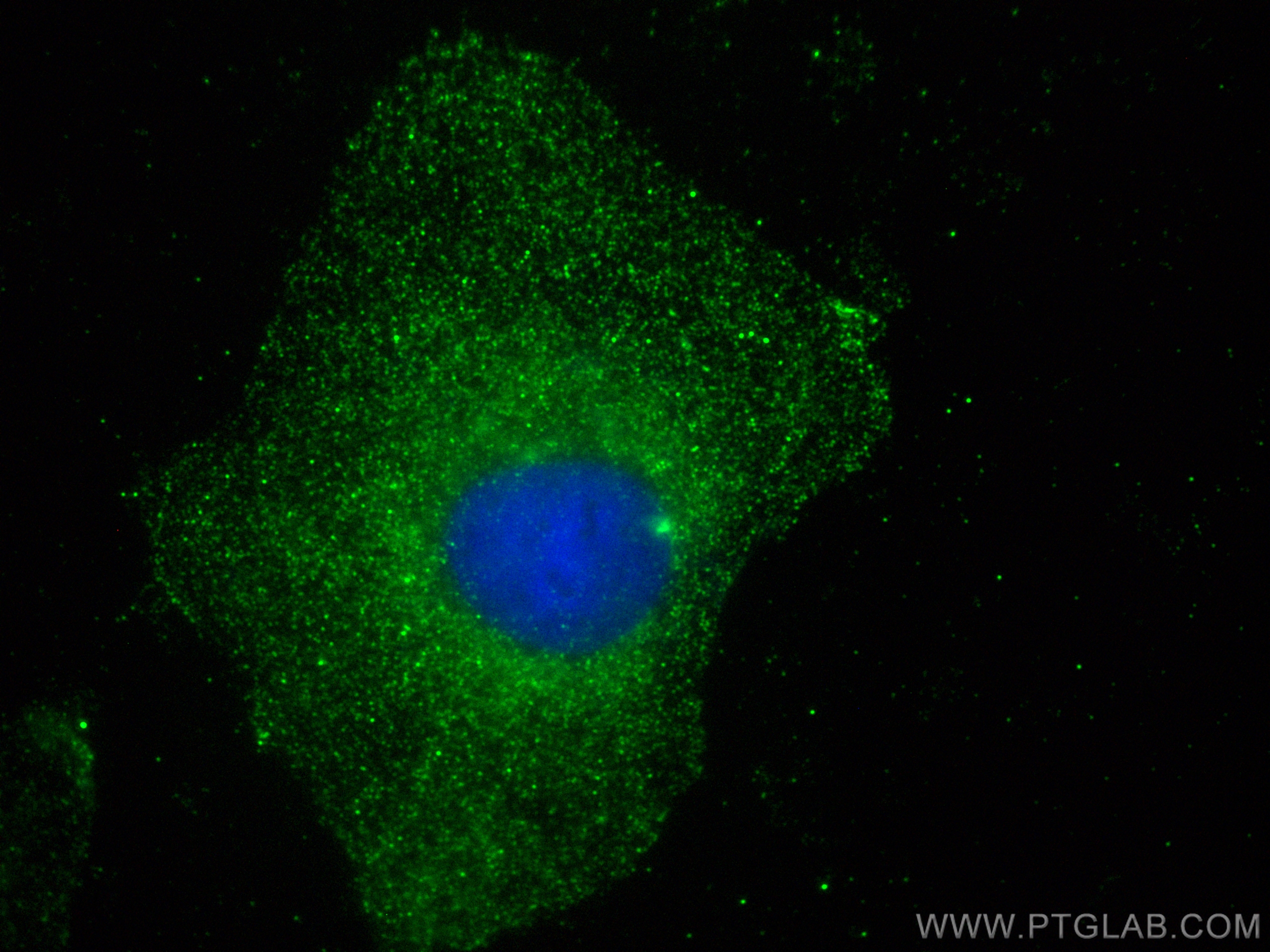 Immunofluorescence (IF) / fluorescent staining of HeLa cells using EPO/Erythropoietin Monoclonal antibody (66975-1-Ig)