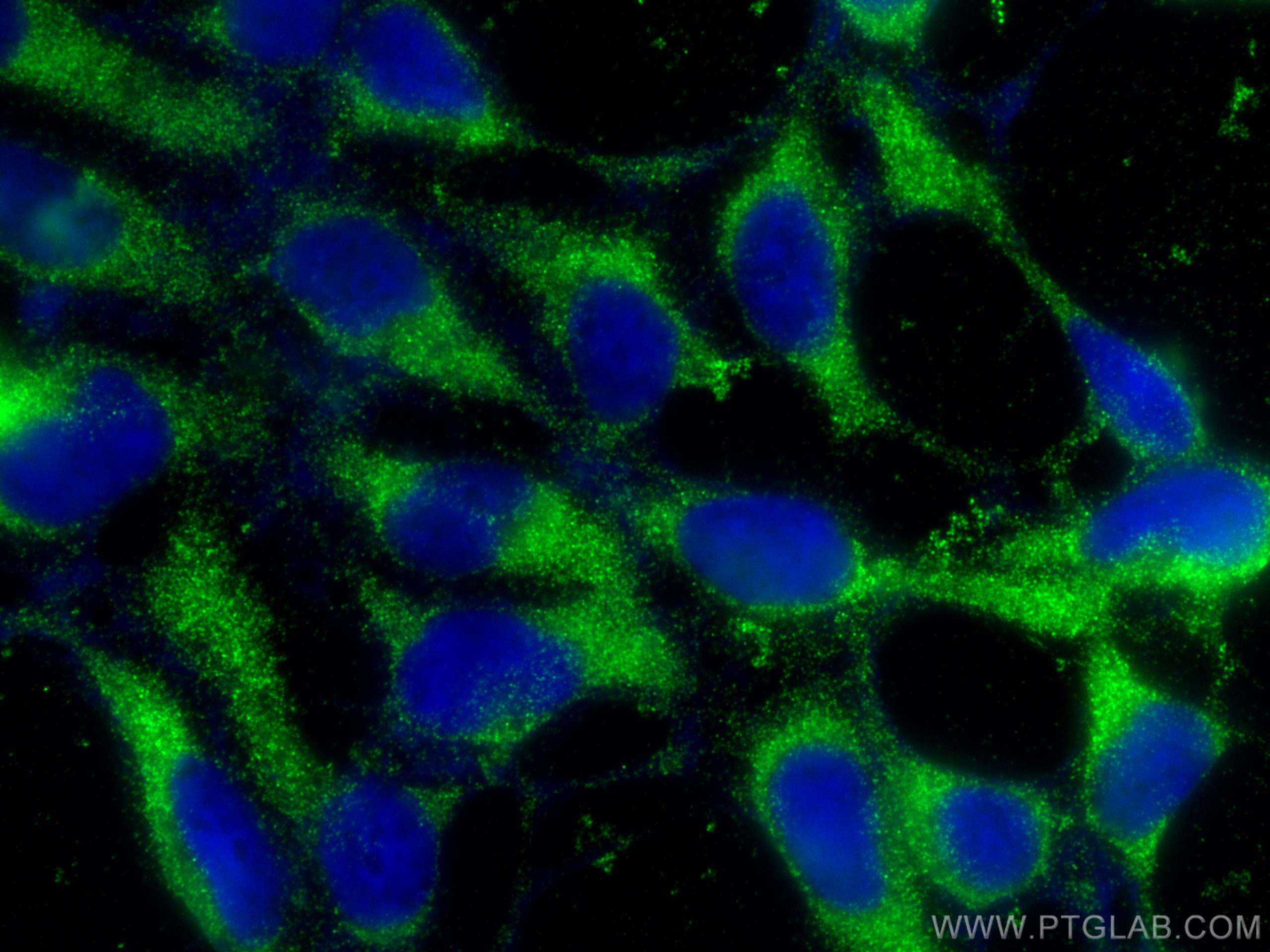 Immunofluorescence (IF) / fluorescent staining of HEK-293 cells using EPRS Polyclonal antibody (25307-1-AP)