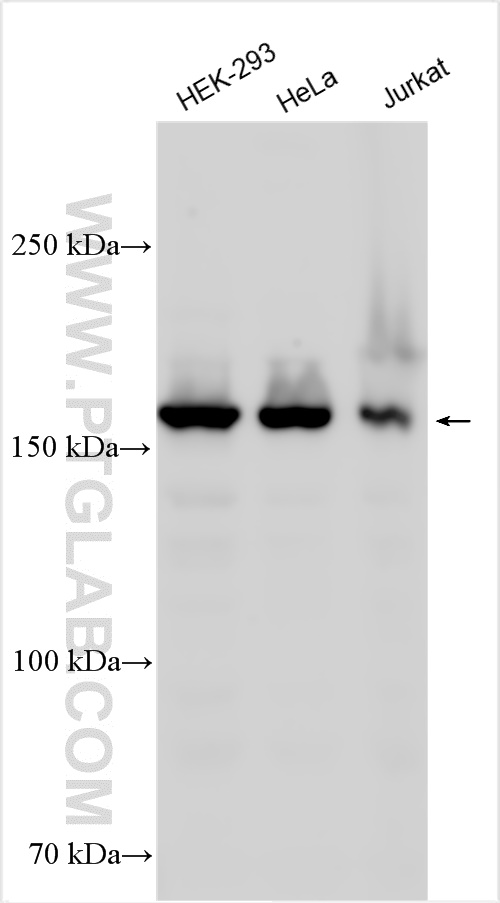 Western Blot (WB) analysis of various lysates using EPRS Polyclonal antibody (25307-1-AP)