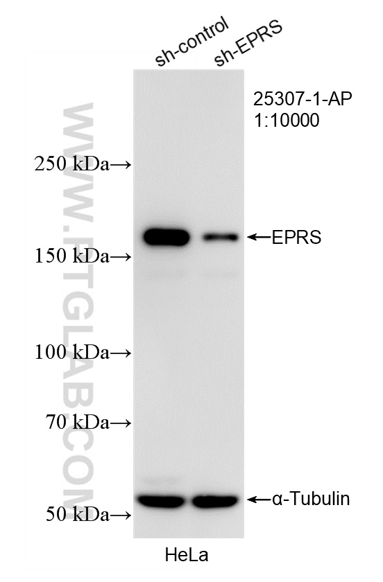 Western Blot (WB) analysis of HeLa cells using EPRS Polyclonal antibody (25307-1-AP)