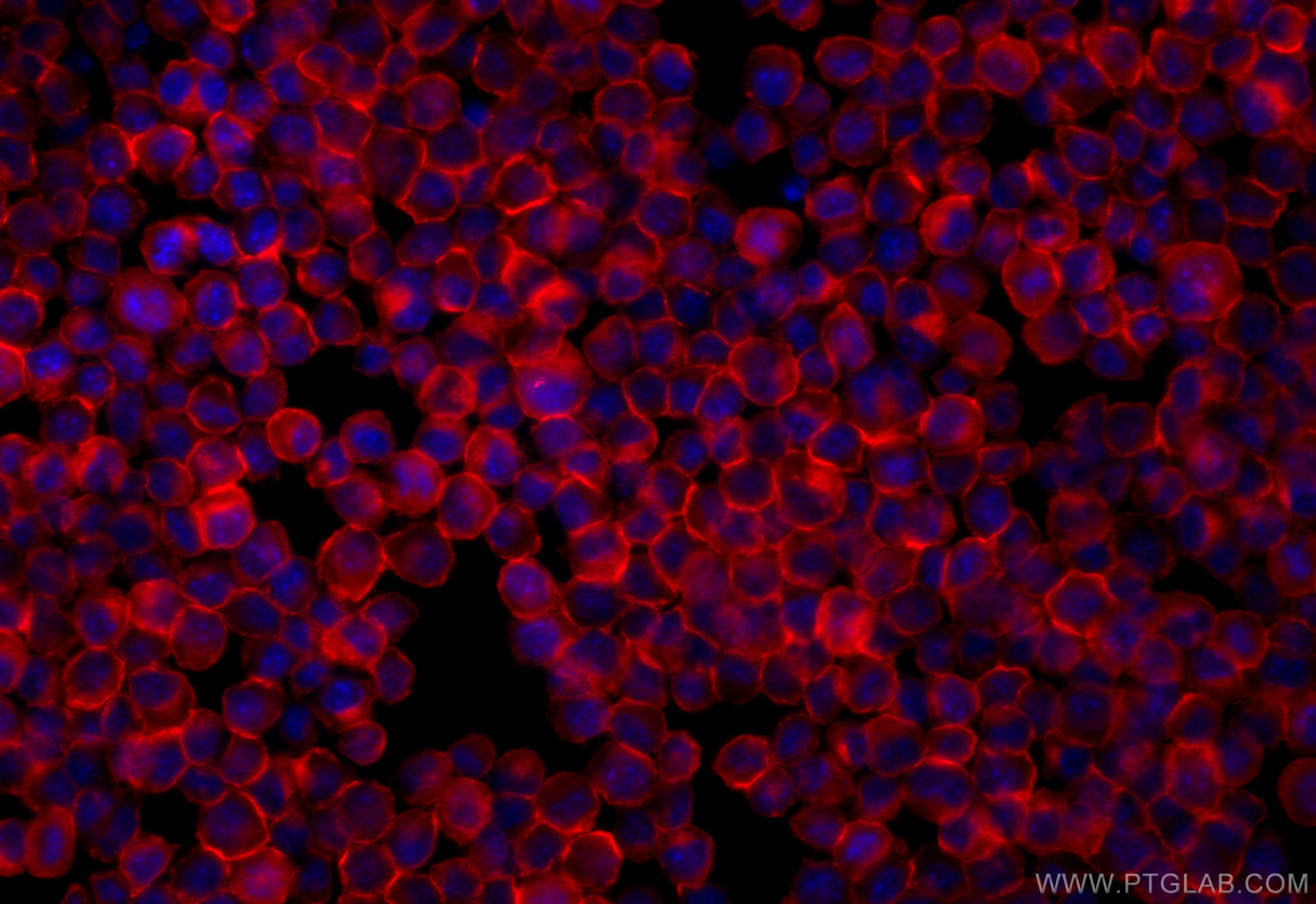 Immunofluorescence (IF) / fluorescent staining of BV-2 cells using EPRS Monoclonal antibody (67712-1-Ig)