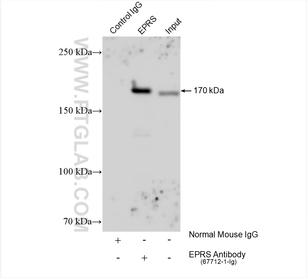 Immunoprecipitation (IP) experiment of HeLa cells using EPRS Monoclonal antibody (67712-1-Ig)