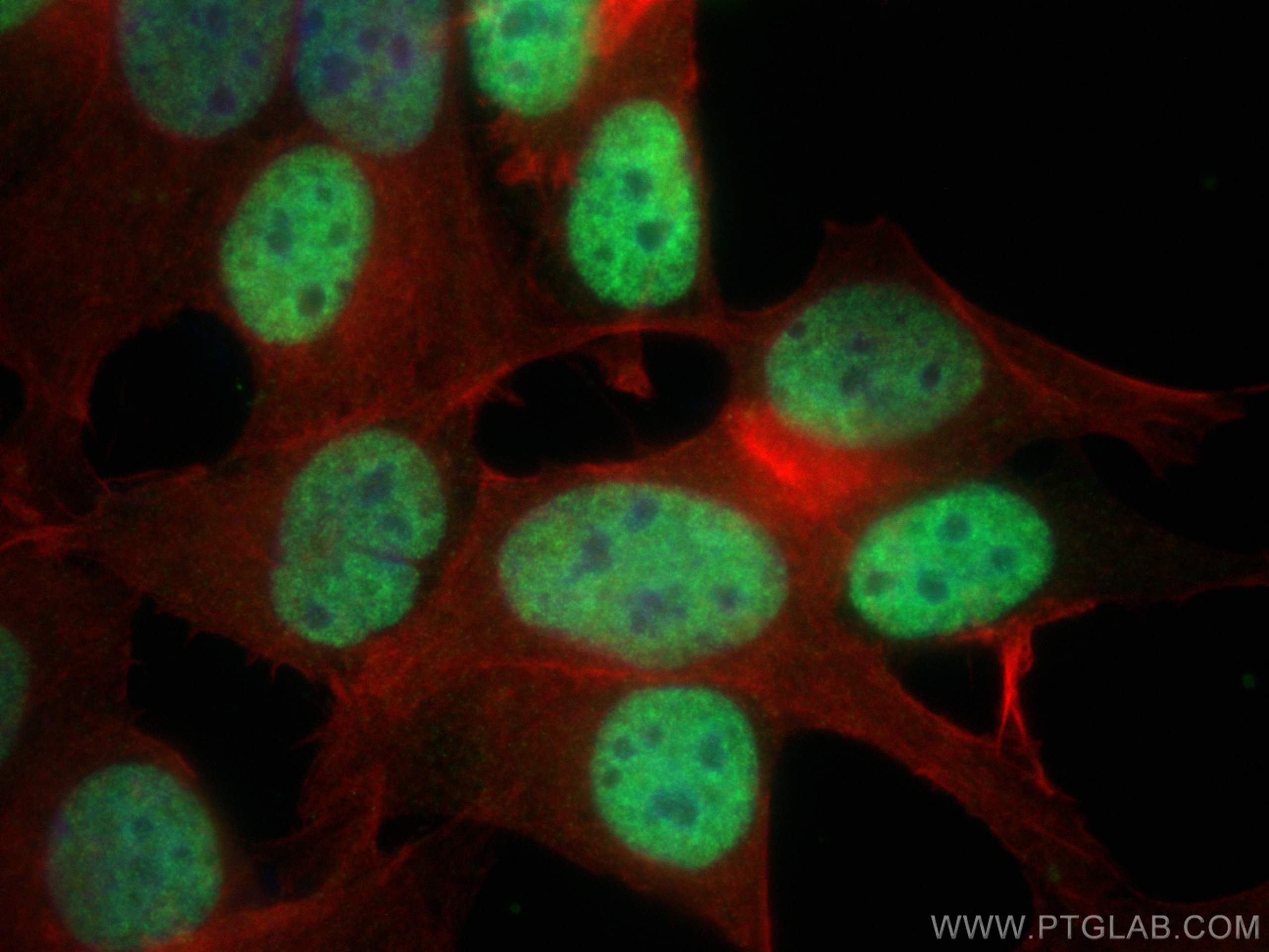 Immunofluorescence (IF) / fluorescent staining of MCF-7 cells using ER Polyclonal antibody (20698-1-AP)