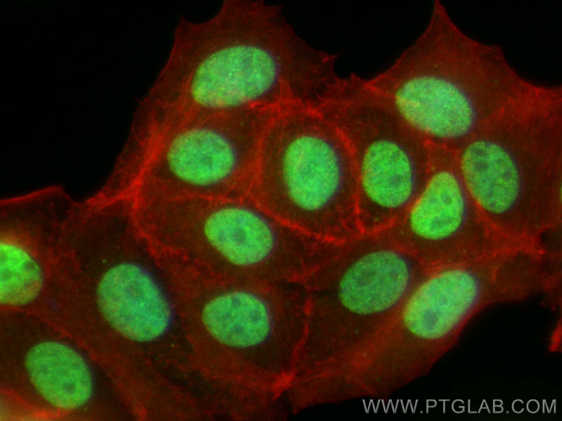 Immunofluorescence (IF) / fluorescent staining of MCF-7 cells using ER Polyclonal antibody (20698-1-AP)