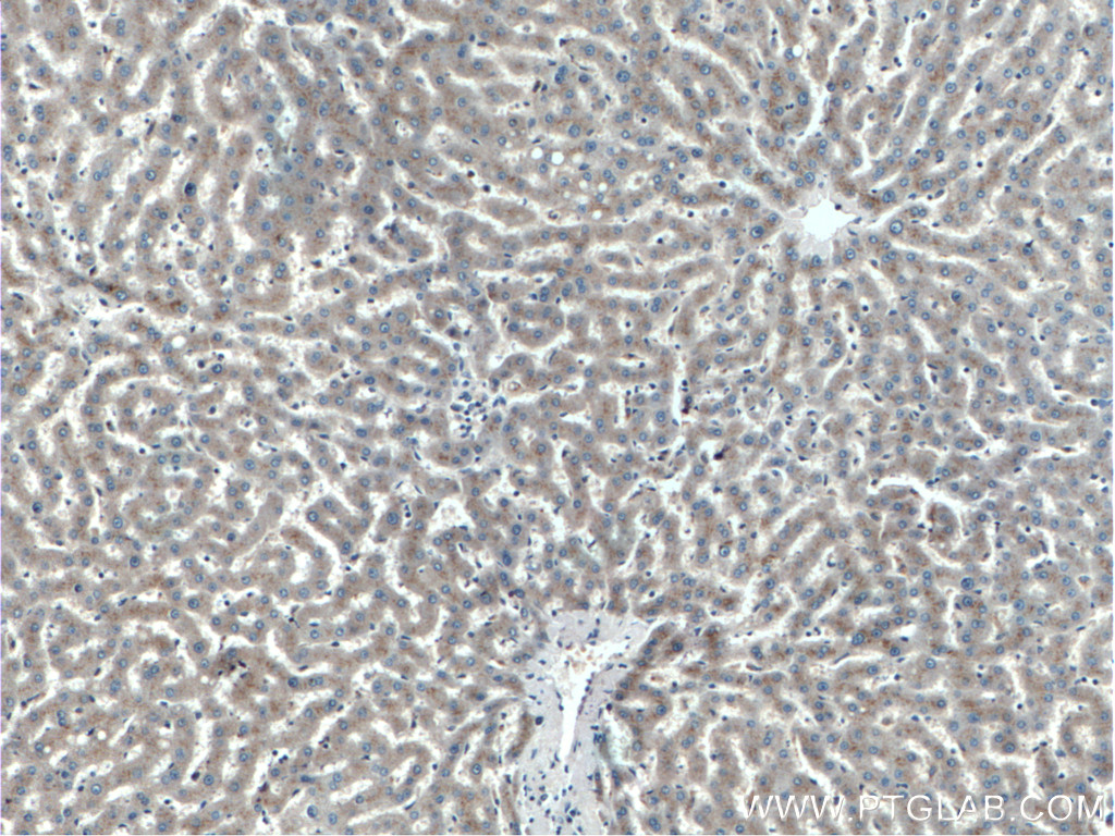 Immunohistochemistry (IHC) staining of human liver tissue using ERAP2 Polyclonal antibody (14637-1-AP)