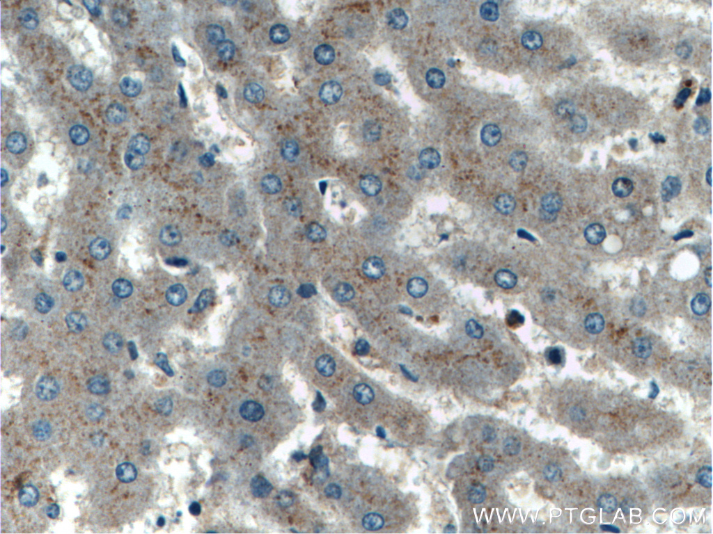 Immunohistochemistry (IHC) staining of human liver tissue using ERAP2 Polyclonal antibody (14637-1-AP)