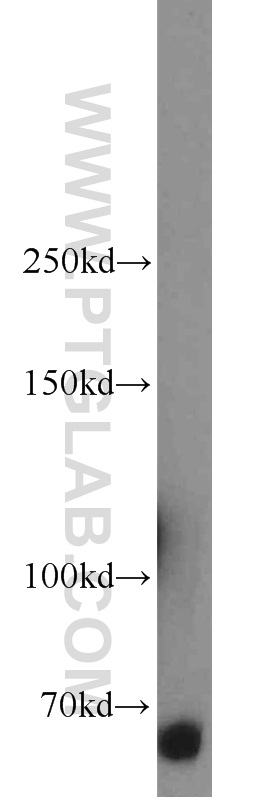 Western Blot (WB) analysis of K-562 cells using ERAP2 Polyclonal antibody (14637-1-AP)