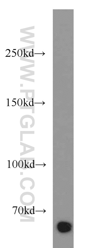 Western Blot (WB) analysis of A549 cells using ERAP2 Polyclonal antibody (14637-1-AP)