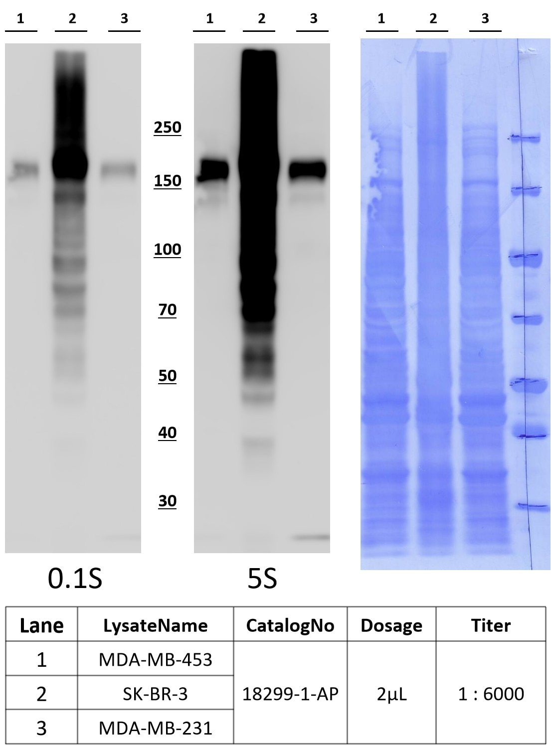 Western Blot (WB) analysis of various lysates using HER2/ErbB2 Polyclonal antibody (18299-1-AP)