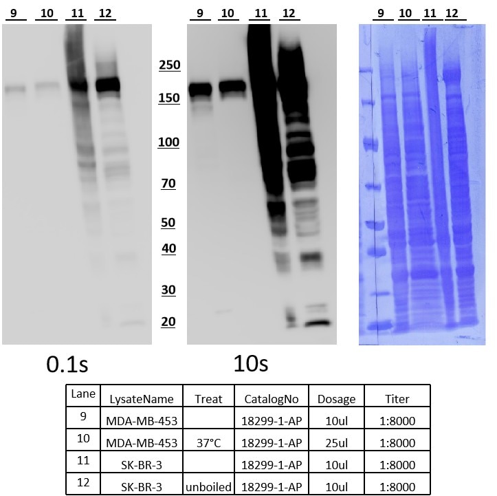 Western Blot (WB) analysis of various lysates using HER2/ErbB2 Polyclonal antibody (18299-1-AP)