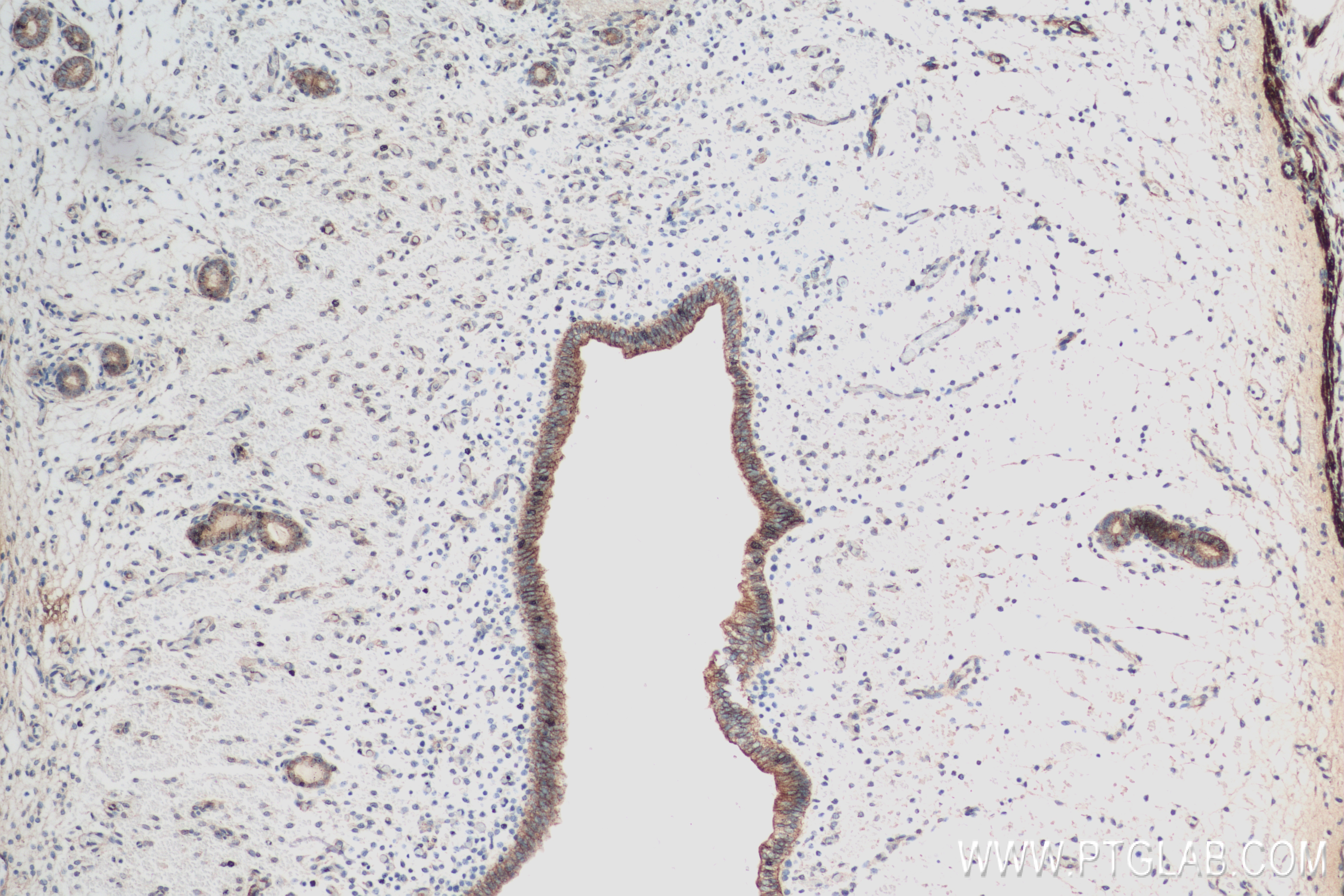 Immunohistochemistry (IHC) staining of mouse uterus tissue using HER2/ErbB2,p185-Specific Recombinant antibody (84046-1-RR)