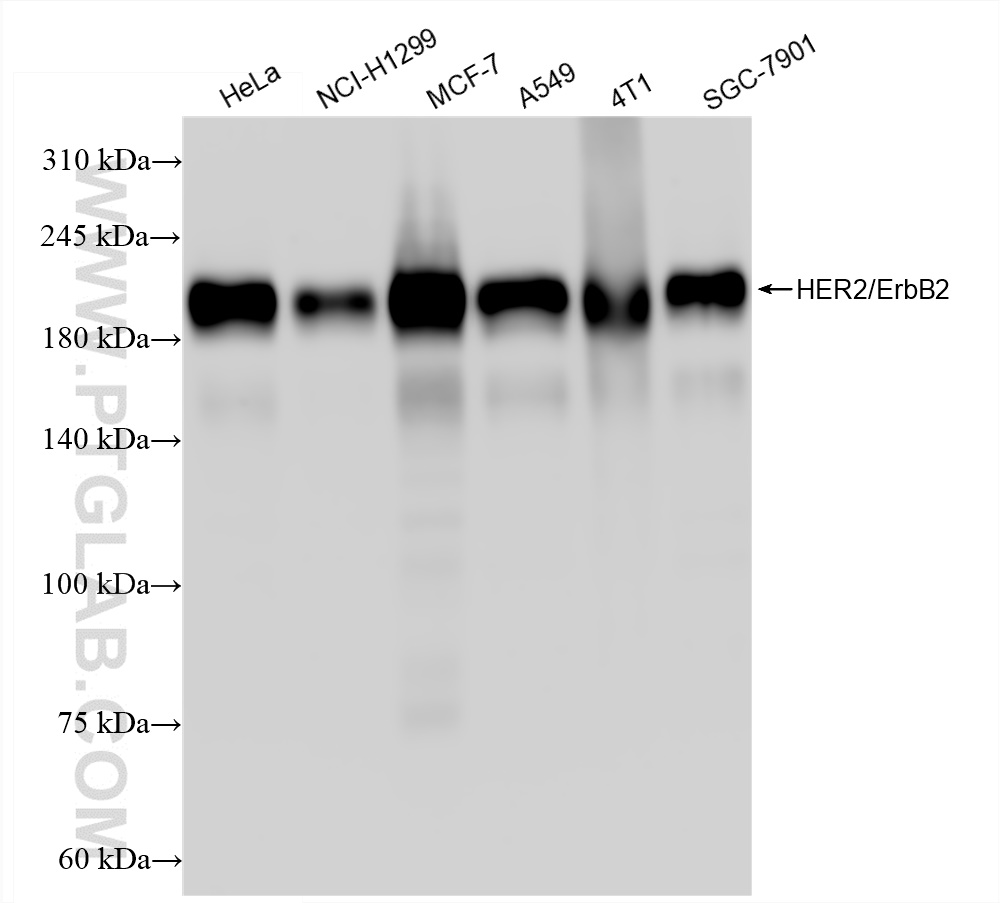 ERBB2,p185-Specific