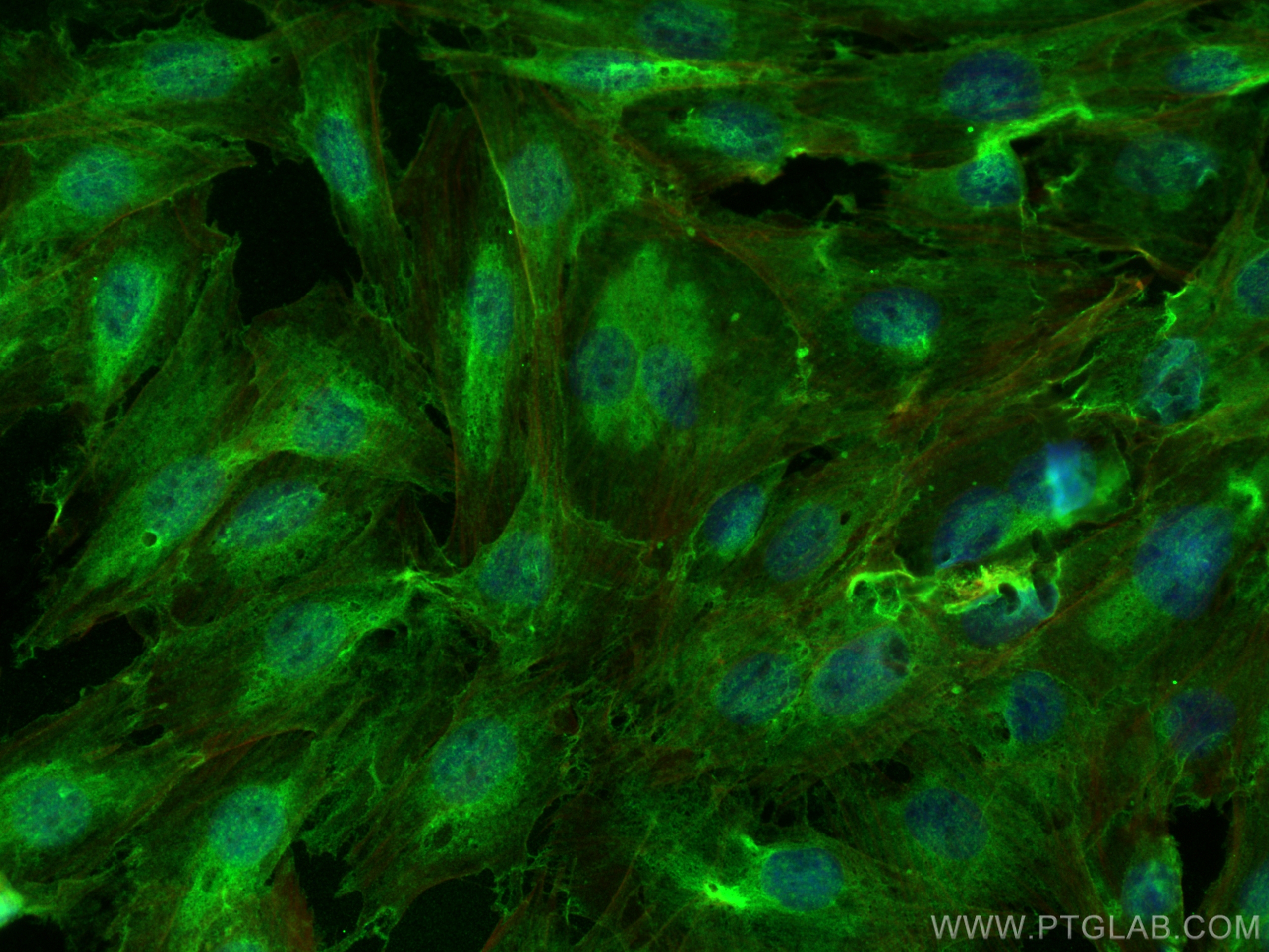 Immunofluorescence (IF) / fluorescent staining of H9C2 cells using ERBB2IP Polyclonal antibody (22438-1-AP)