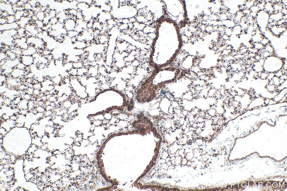 Immunohistochemistry (IHC) staining of mouse lung tissue using ERBB4 Polyclonal antibody (19943-1-AP)