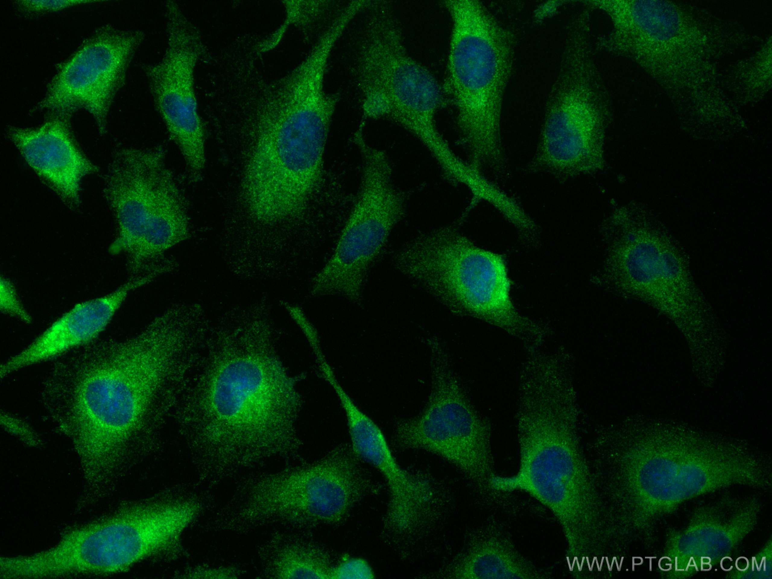 Immunofluorescence (IF) / fluorescent staining of HeLa cells using ERC2 Polyclonal antibody (21396-1-AP)