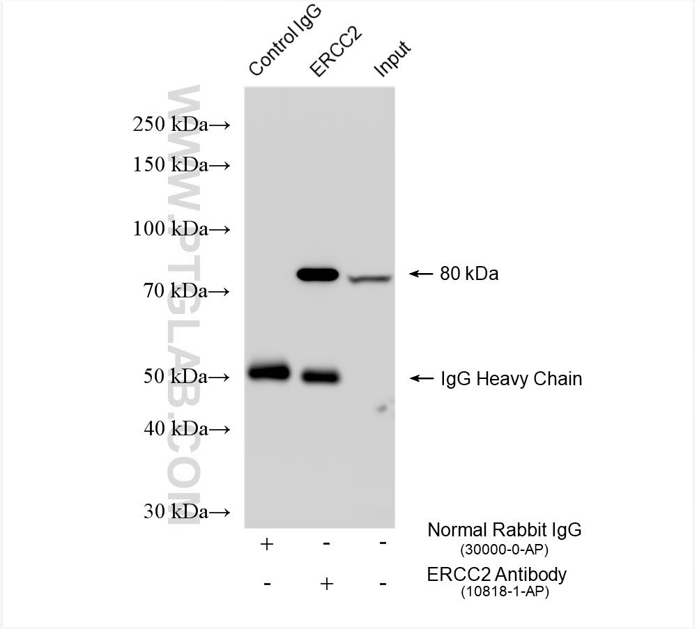 Immunoprecipitation (IP) experiment of HEK-293 cells using ERCC2 Polyclonal antibody (10818-1-AP)