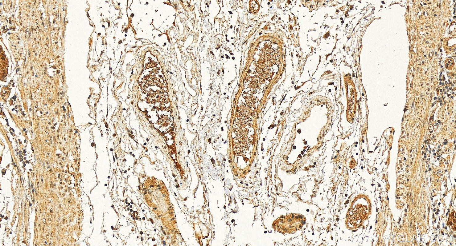 Immunohistochemistry (IHC) staining of human stomach tissue using ERCC3 Polyclonal antibody (10580-1-AP)