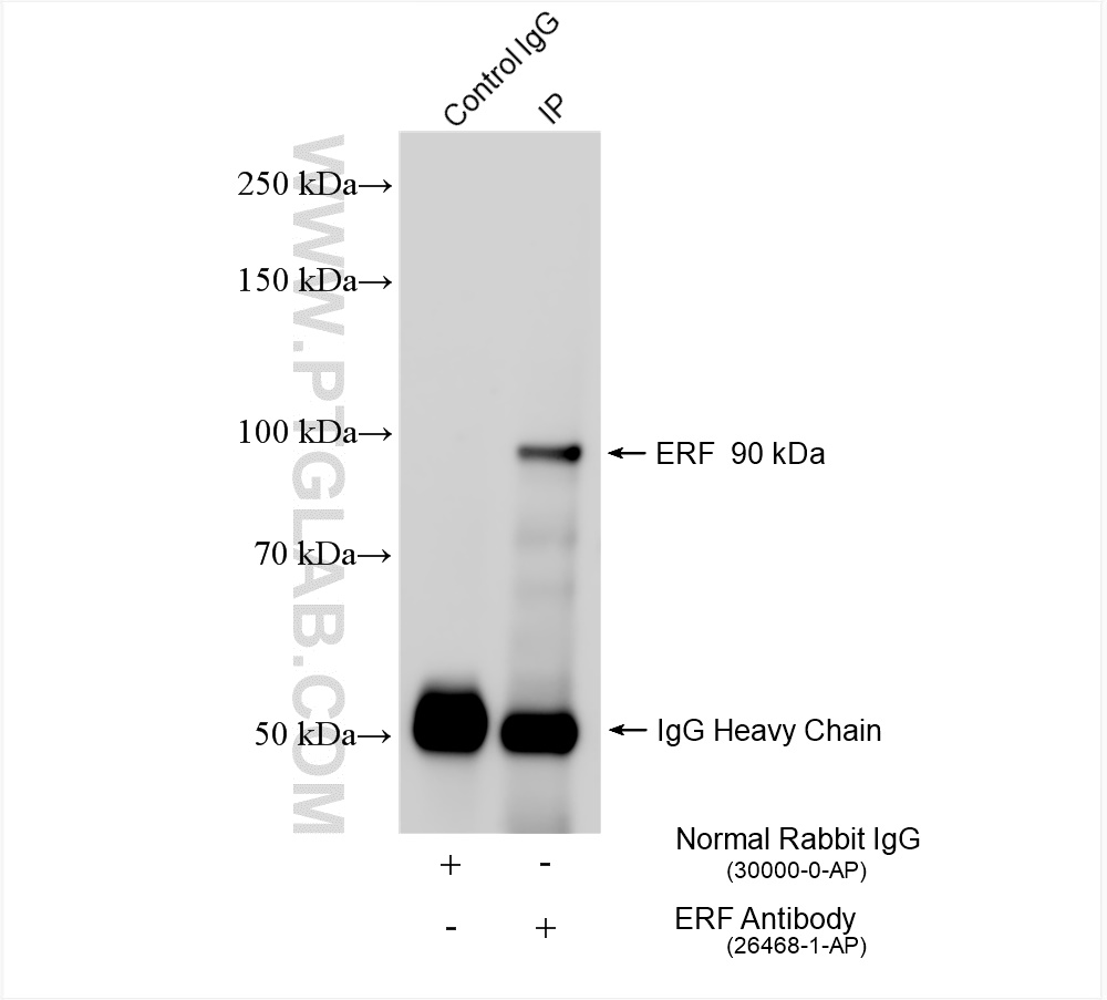 Immunoprecipitation (IP) experiment of A431 cells using ERF Polyclonal antibody (26468-1-AP)