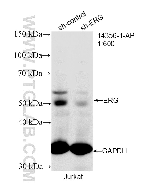 Western Blot (WB) analysis of Jurkat cells using ERG Polyclonal antibody (14356-1-AP)
