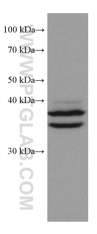Western Blot (WB) analysis of PC-12 cells using ERK1/2 Monoclonal antibody (67170-1-Ig)