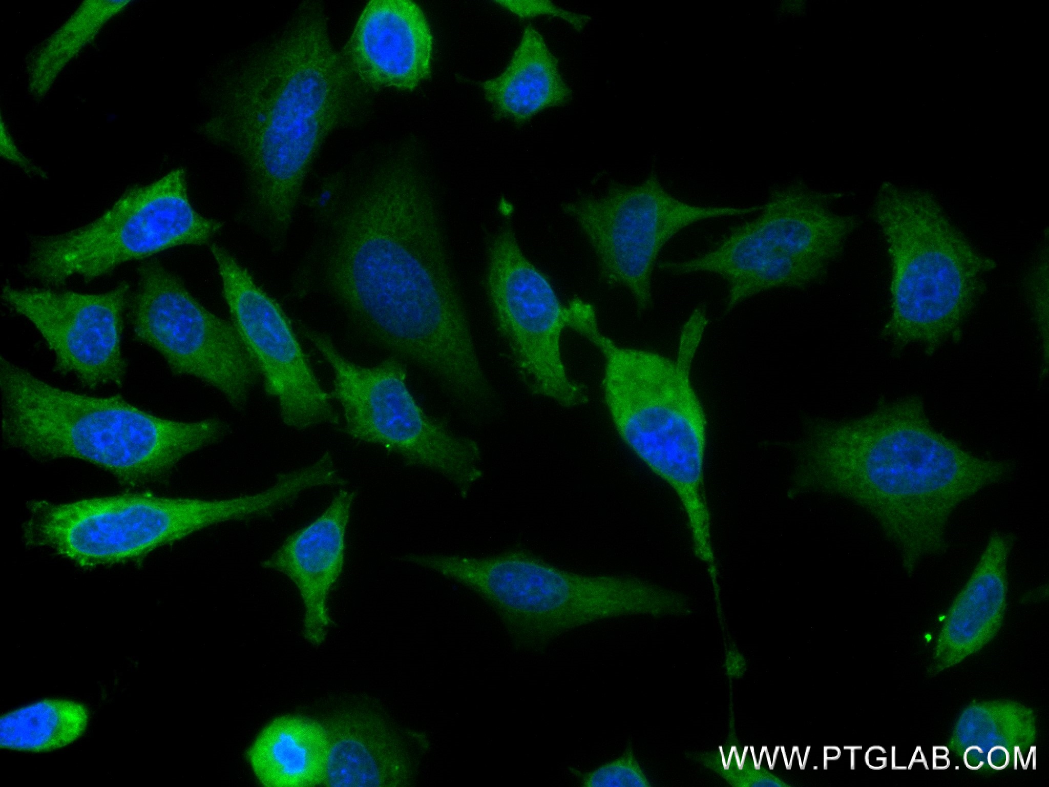 Immunofluorescence (IF) / fluorescent staining of HeLa cells using ERK1/2 Recombinant antibody (83533-1-RR)