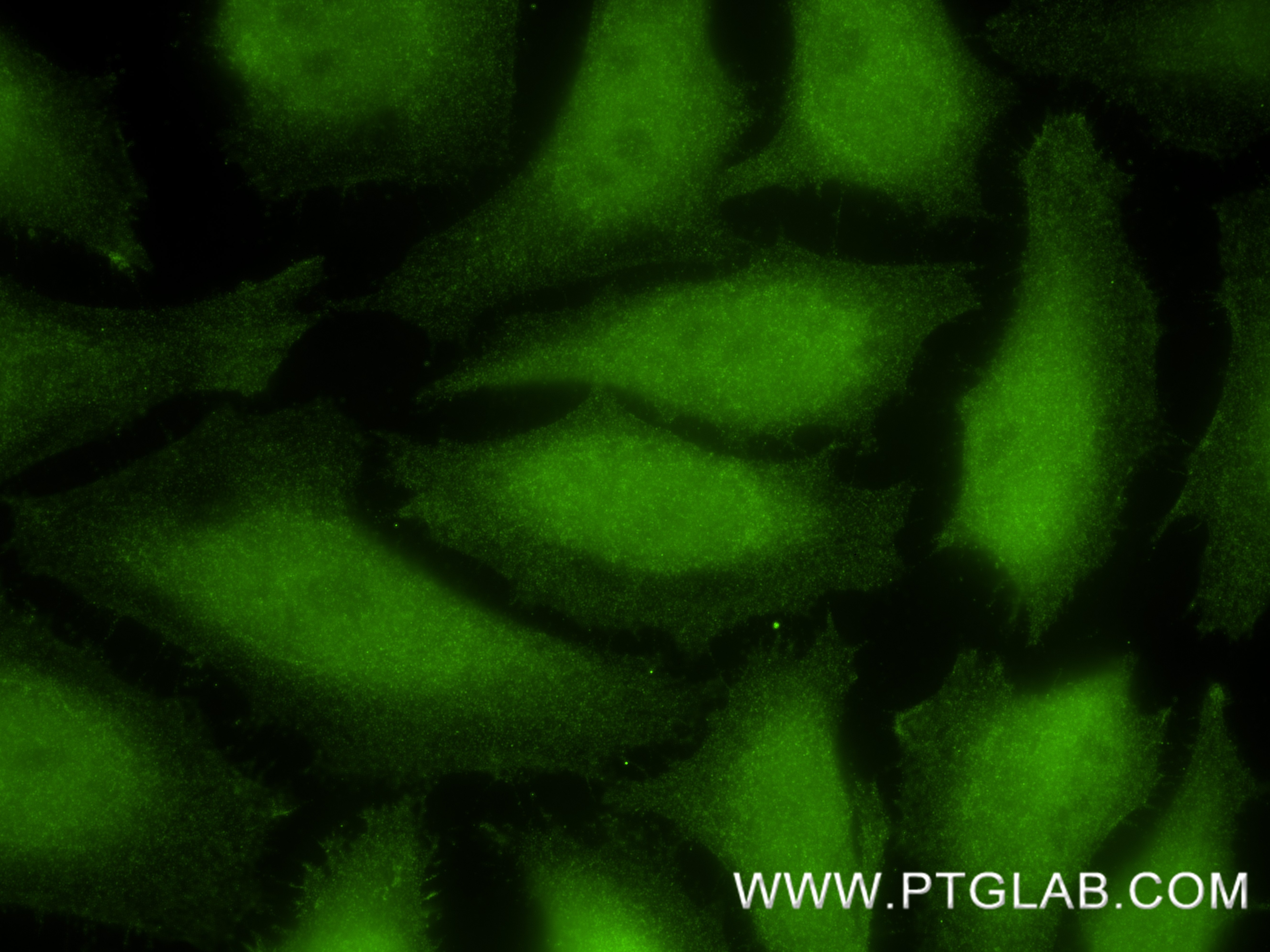 Immunofluorescence (IF) / fluorescent staining of HeLa cells using ERK1/2 Recombinant monoclonal antibody (83533-1-RR)